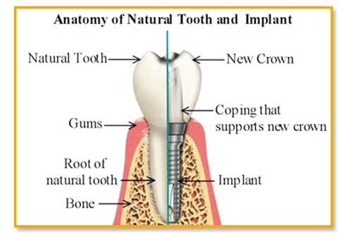 Root Canal Treatments